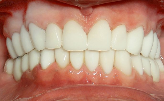 After - Wiltondental