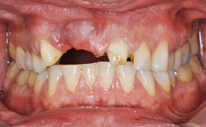 Before - Wiltondental